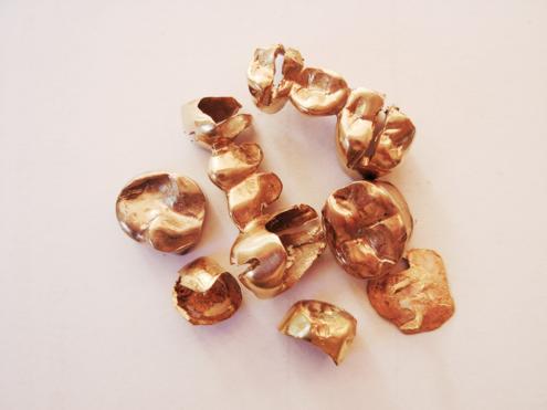 Zahngold Goldzähne